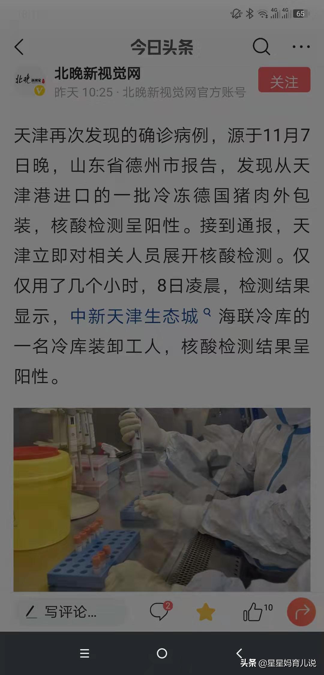 欧洲杯发布会直播:欧洲杯发布会直播在哪看